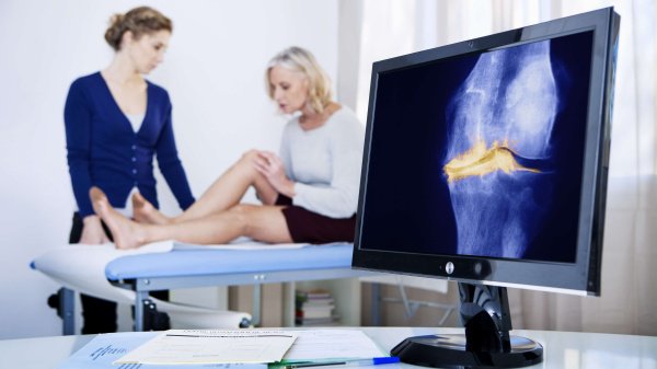 Frau auf Patientenliege mit Blick auf angewinkeltes Knie und Ärztin daneben.