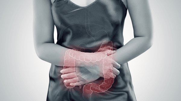 Frau umfasst vor Bauchschmerzen ihren Bauch. Schematisch und rot eingezeichneter Dickdarm.