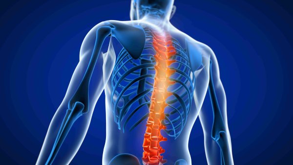 Rückenansicht eines Menschen mit farblich hervorgehobener Wirbelsäule.