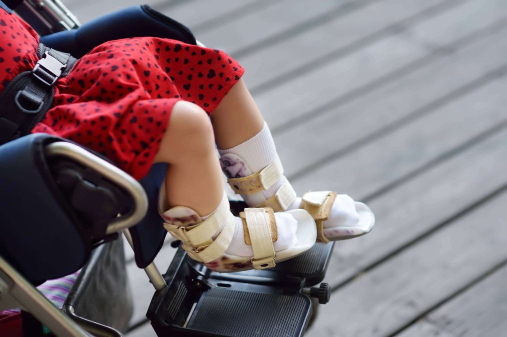 Blick auf die Beine eines Kindes im Rollstuhl.