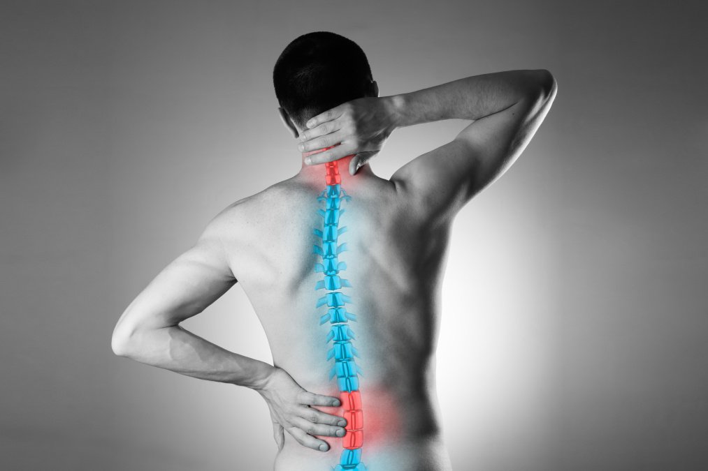 Darstellung eines männlichen Oberkörpers, welcher Schmerzen der Wirbelsäule infolge von Spondylopathie aufweist.